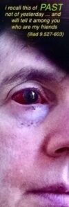 working bitterness in the blood and faith lost, for the terror returns like sickness to lurk in the house; secret anger remembers the child that shall be avenged, rang out the voice of Kalchas (Agamemnon 152-155)